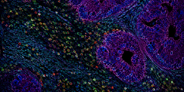 From last‑chance therapy to cancer boosters: A 2050 vision of immunoprevention in high‑risk populations